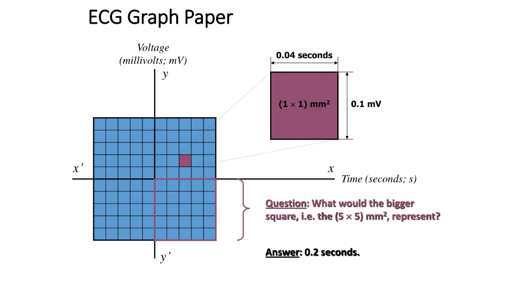 ecg graph paper ecg graph paper