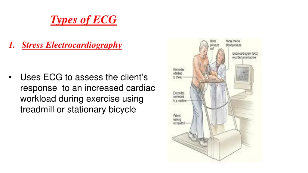 types of ecg