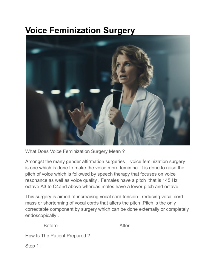 voice feminization surgery