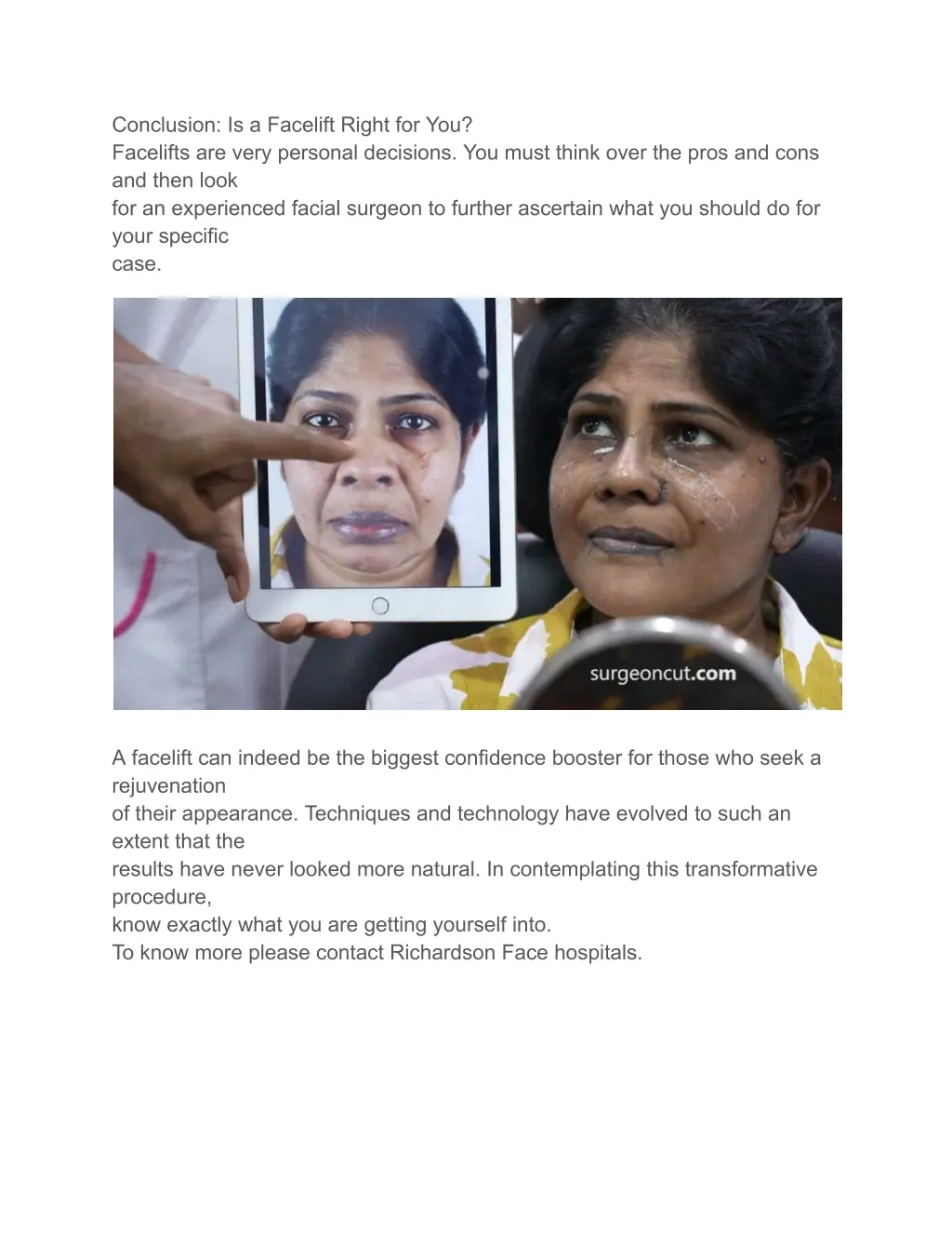 conclusion is a facelift right for you facelifts