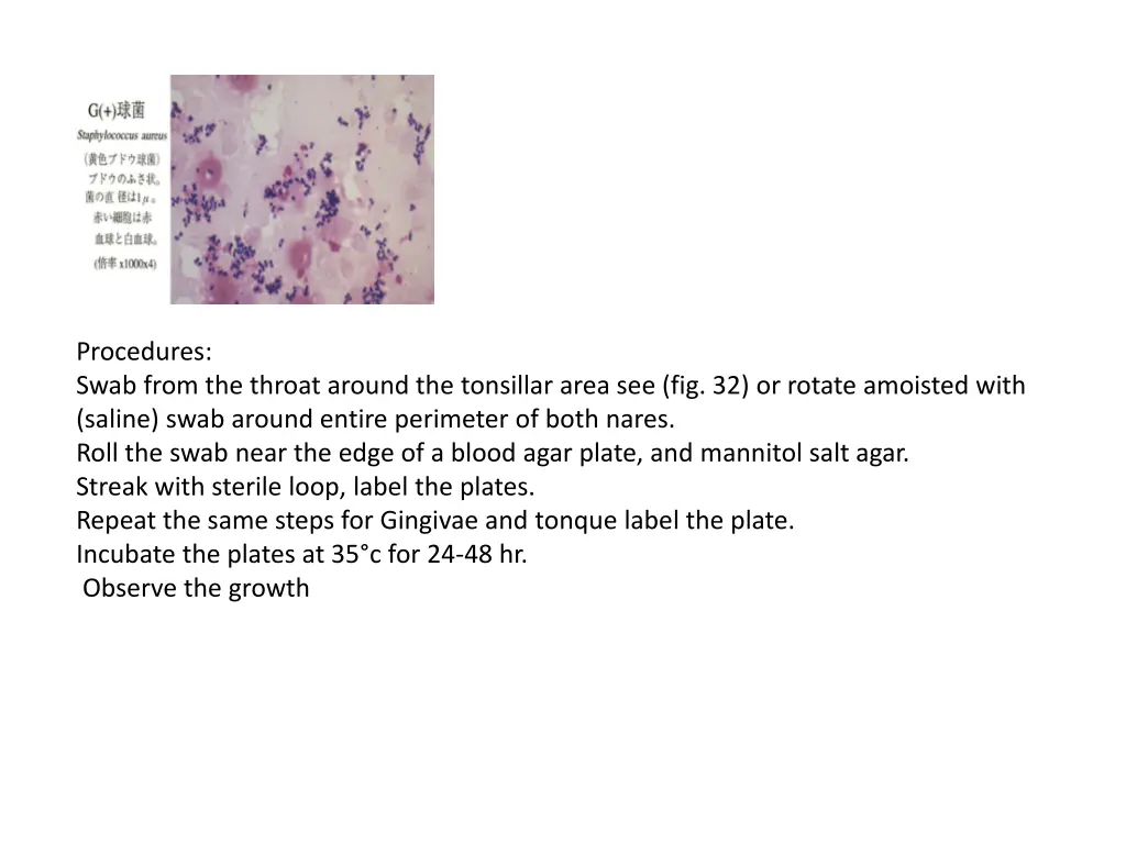 procedures swab from the throat around
