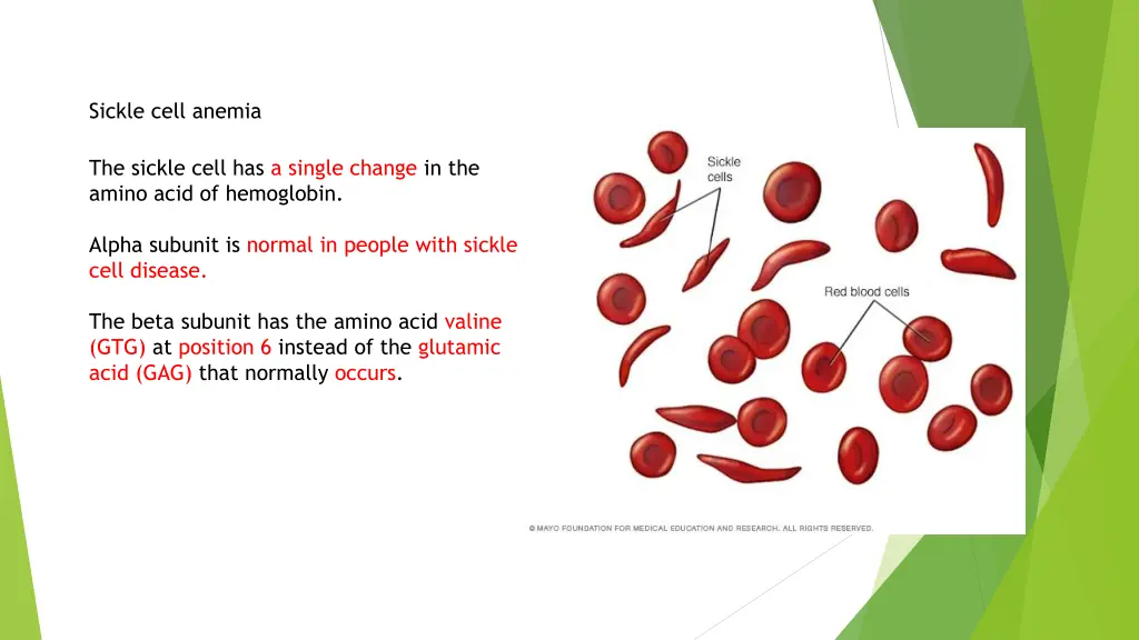 sickle cell anemia 2