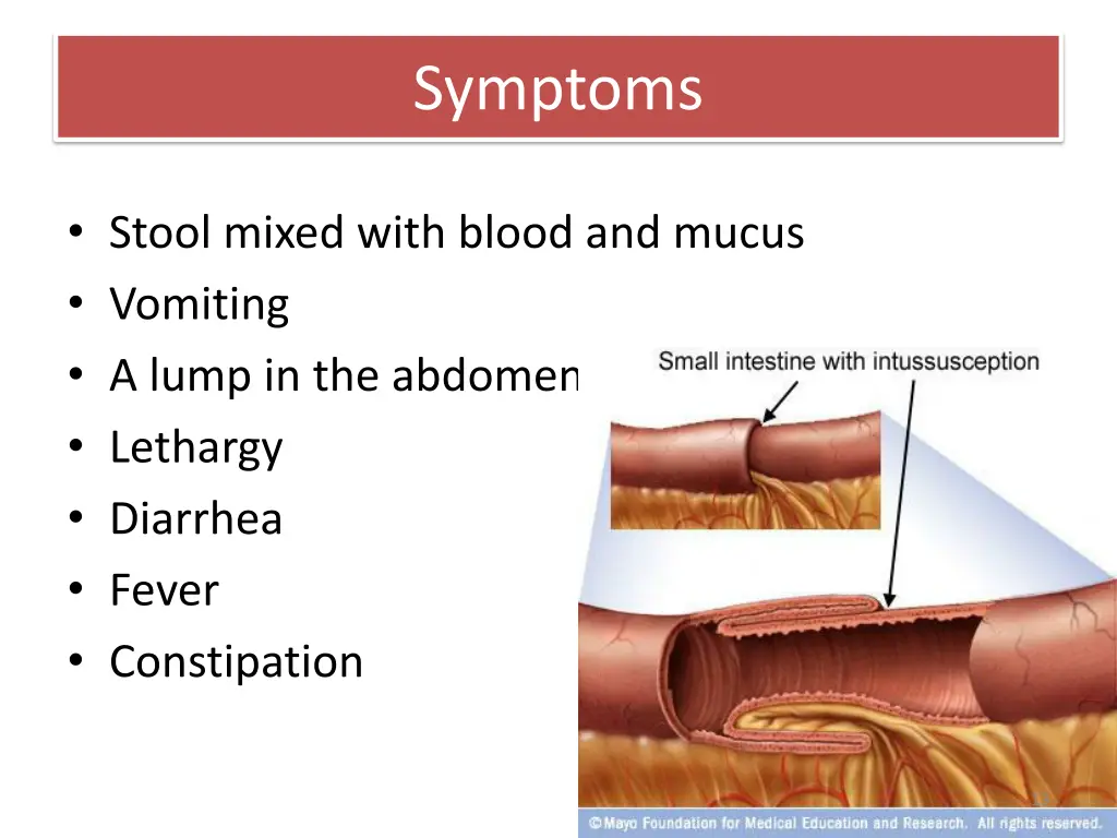 symptoms