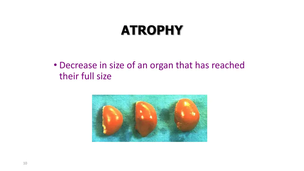 atrophy