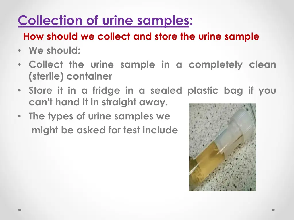 collection of urine samples how should we collect