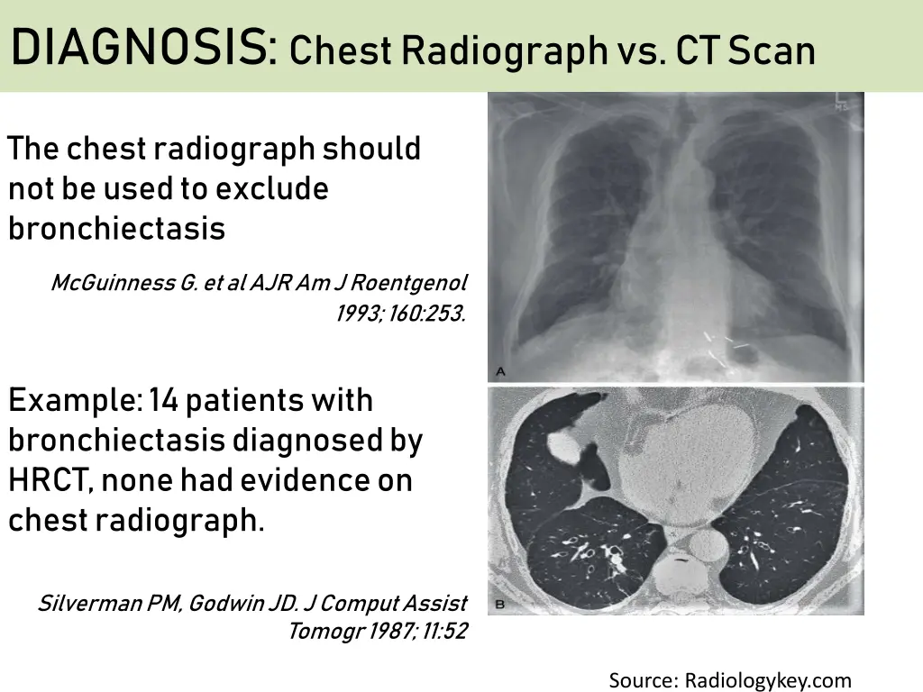 diagnosis chest radiograph vs ct scan