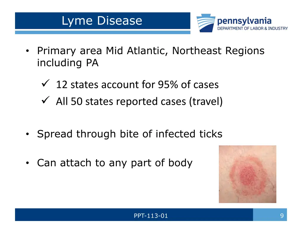 lyme disease