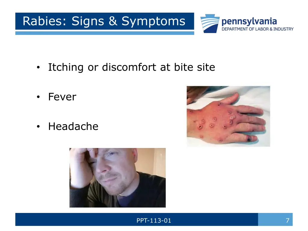 rabies signs symptoms