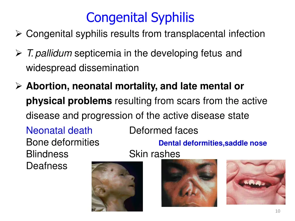 congenital syphilis