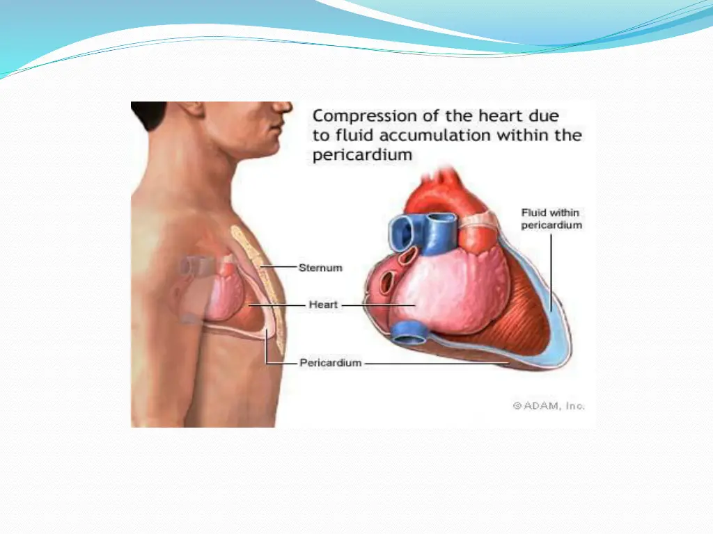 slide30