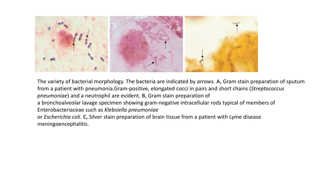 the variety of bacterial morphology the bacteria