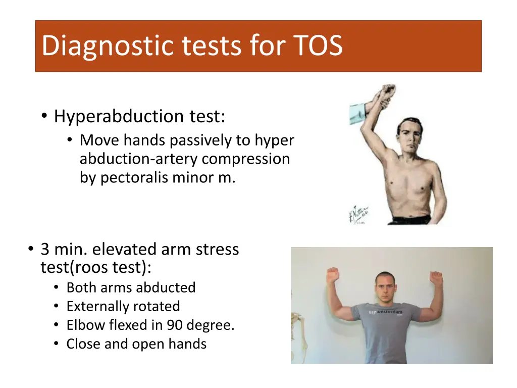 diagnostic tests for tos 1