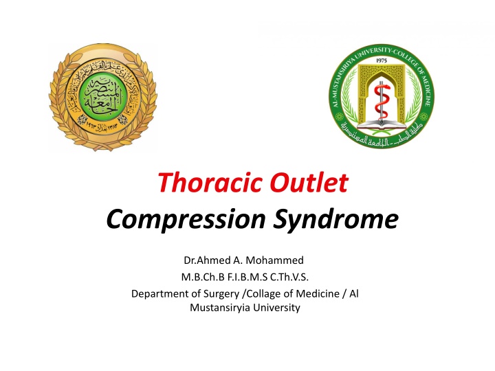 thoracic outlet compression syndrome