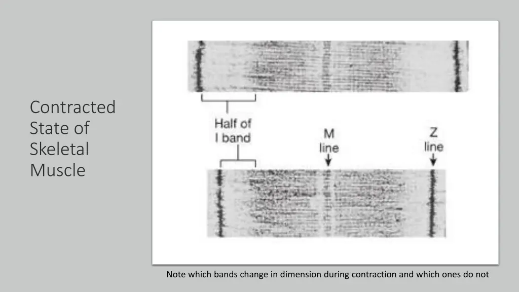 contracted state of skeletal muscle