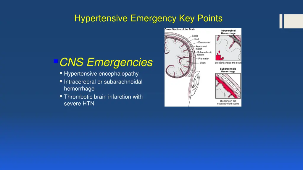 hypertensive emergency key points