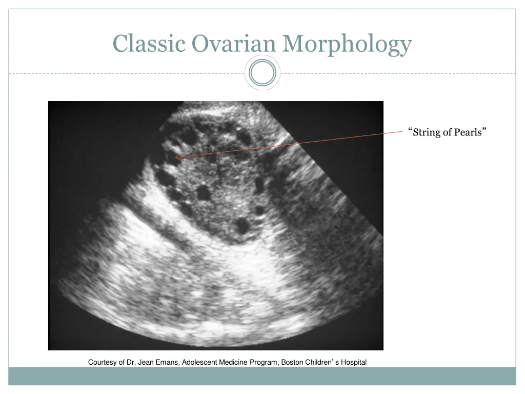classic ovarian morphology