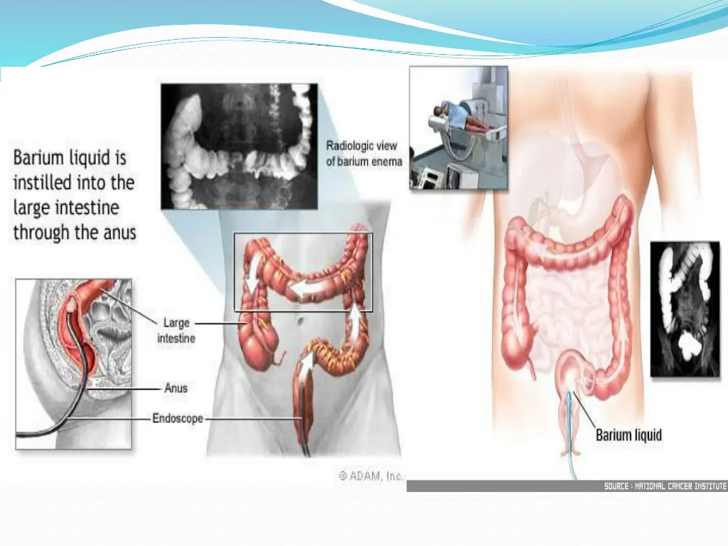 slide36