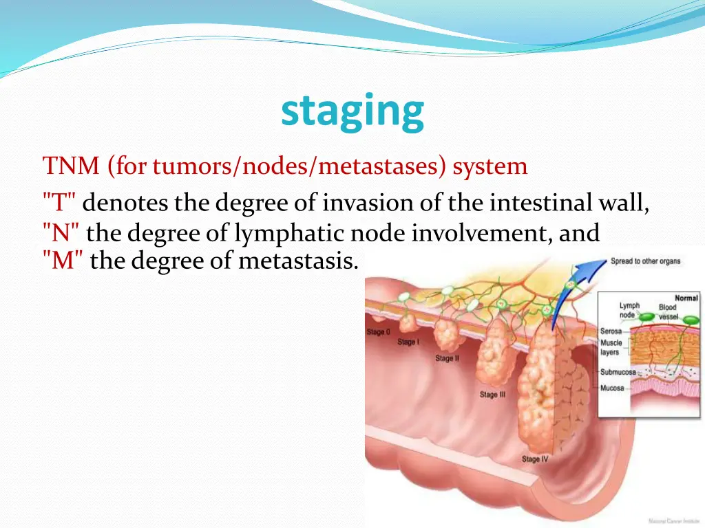 staging