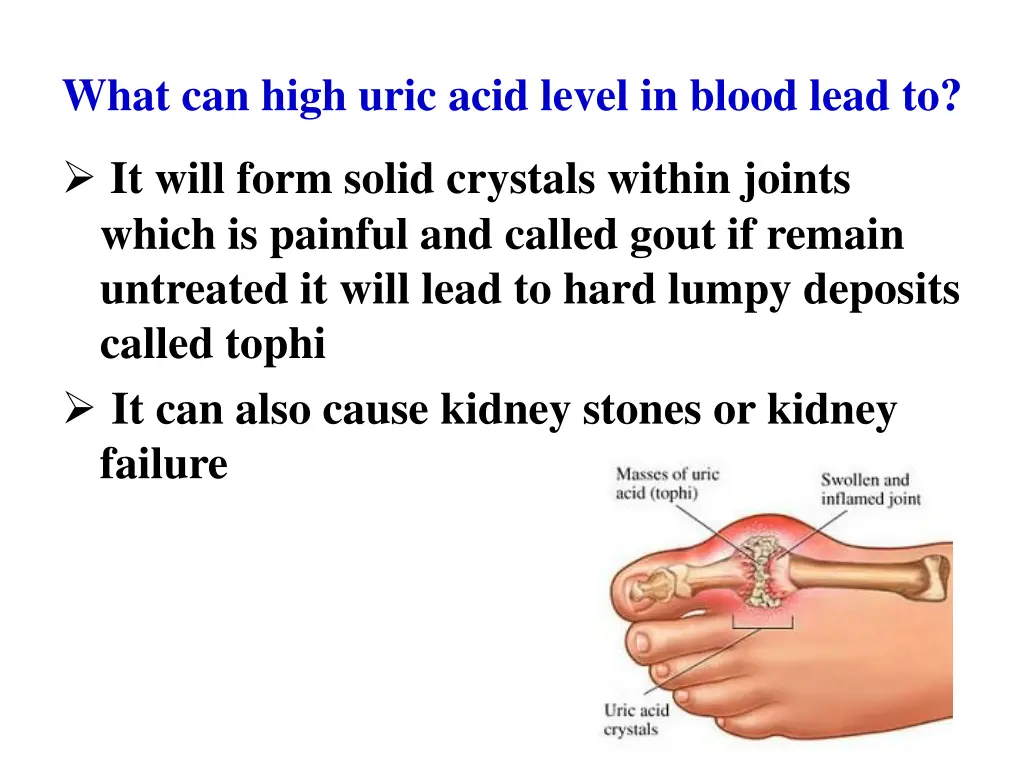 what can high uric acid level in blood lead to