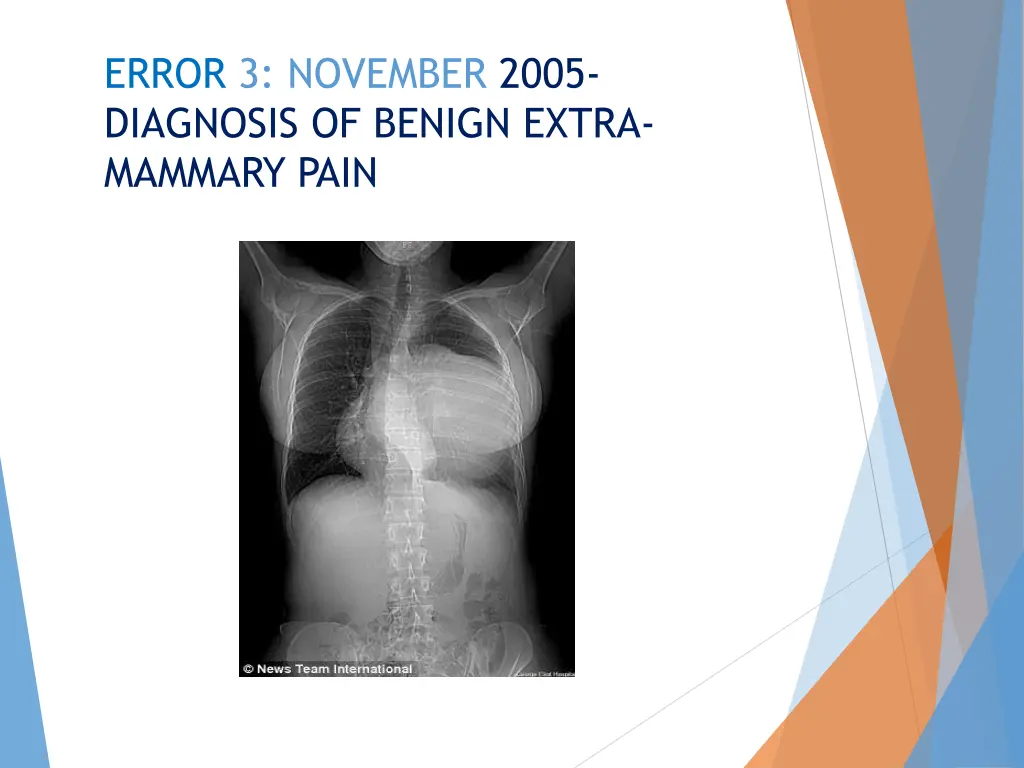 error 3 november 2005 diagnosis of benign extra
