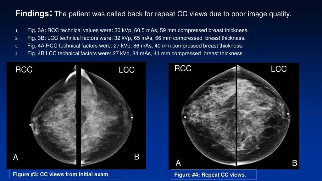 findings the patient was called back for repeat