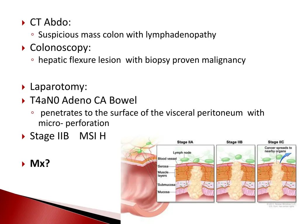ct abdo suspicious mass colon with