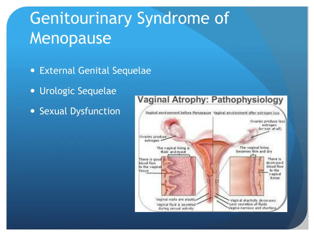 genitourinary syndrome of menopause