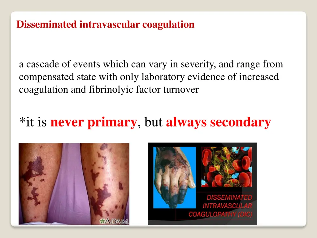 disseminated intravascular coagulation