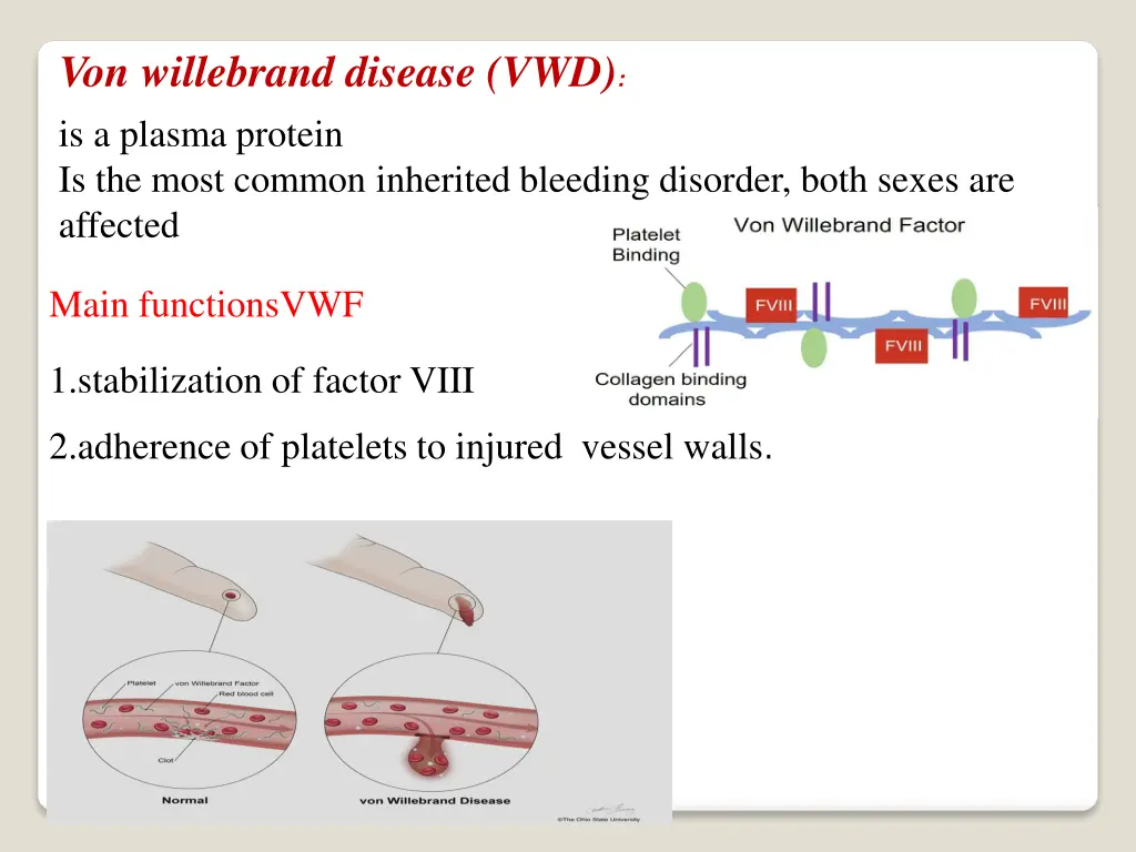 von willebrand disease vwd is a plasma protein