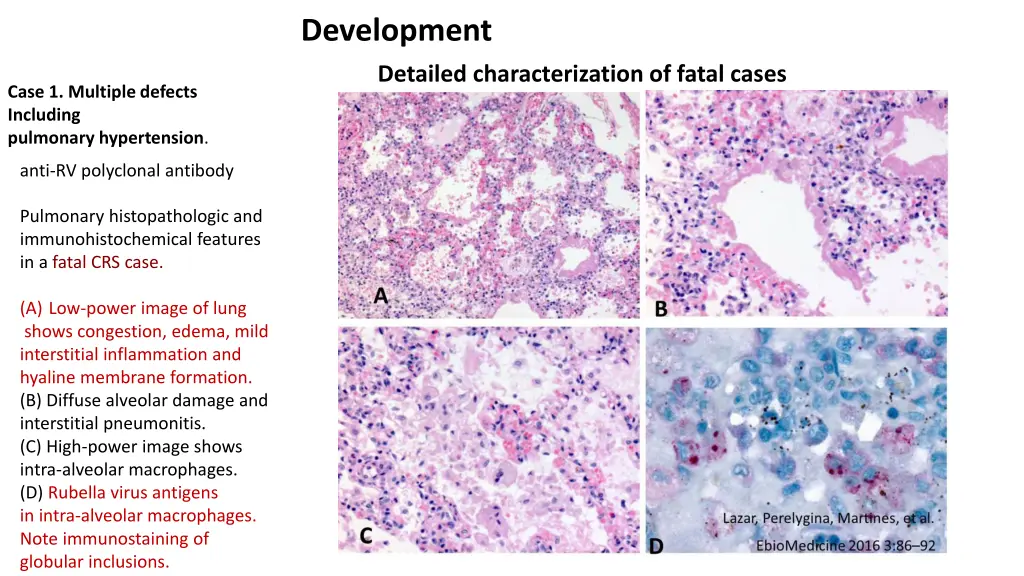 development detailed characterization of fatal