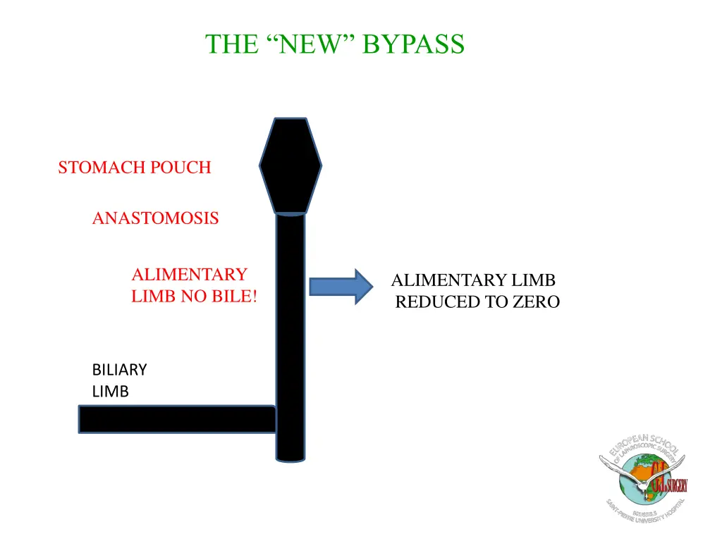 the new bypass 1