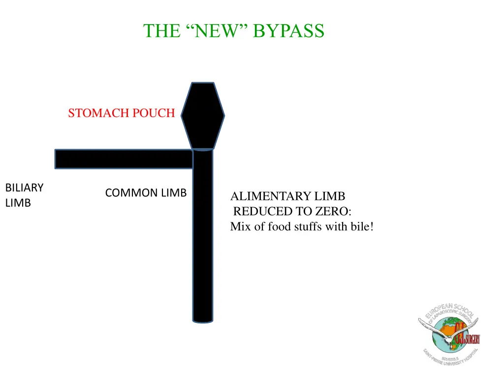 the new bypass 2