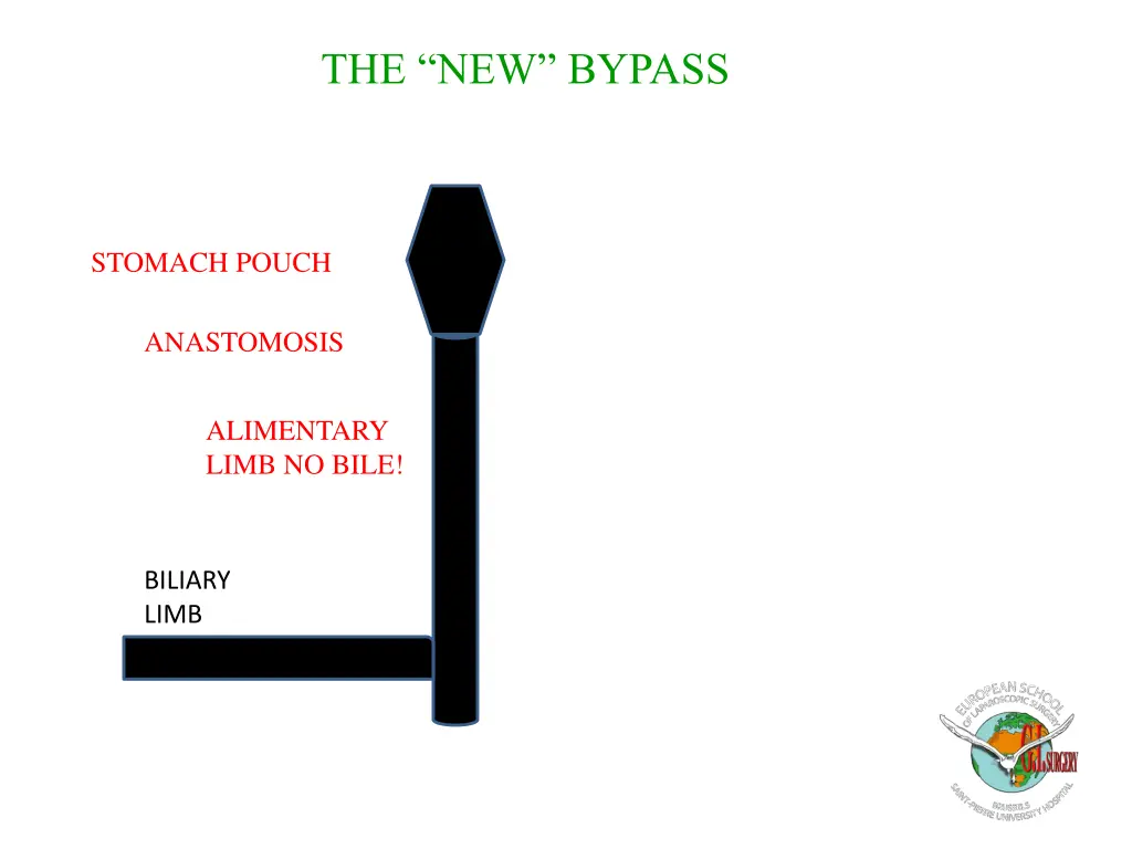 the new bypass