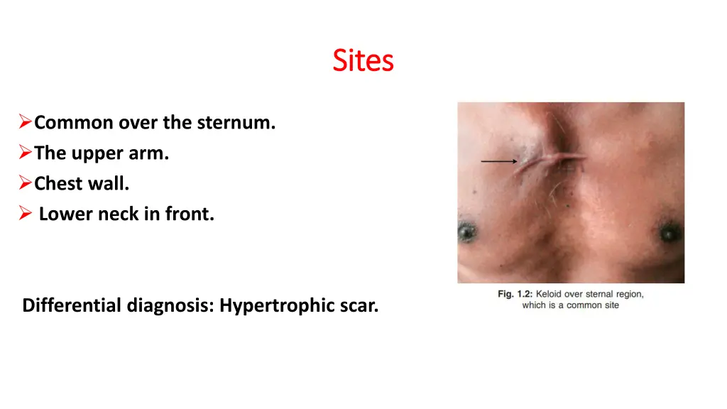 sites sites
