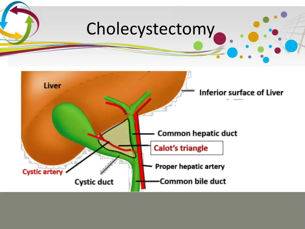 cholecystectomy 10