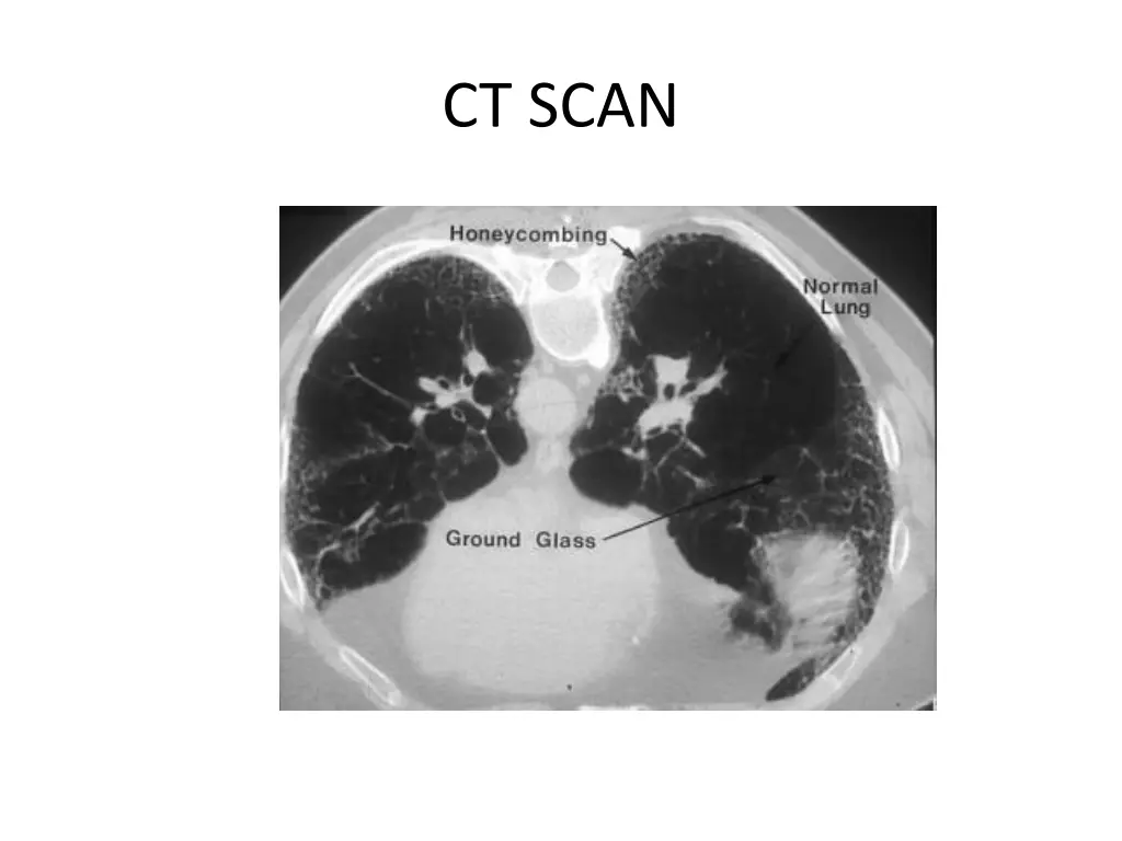 ct scan
