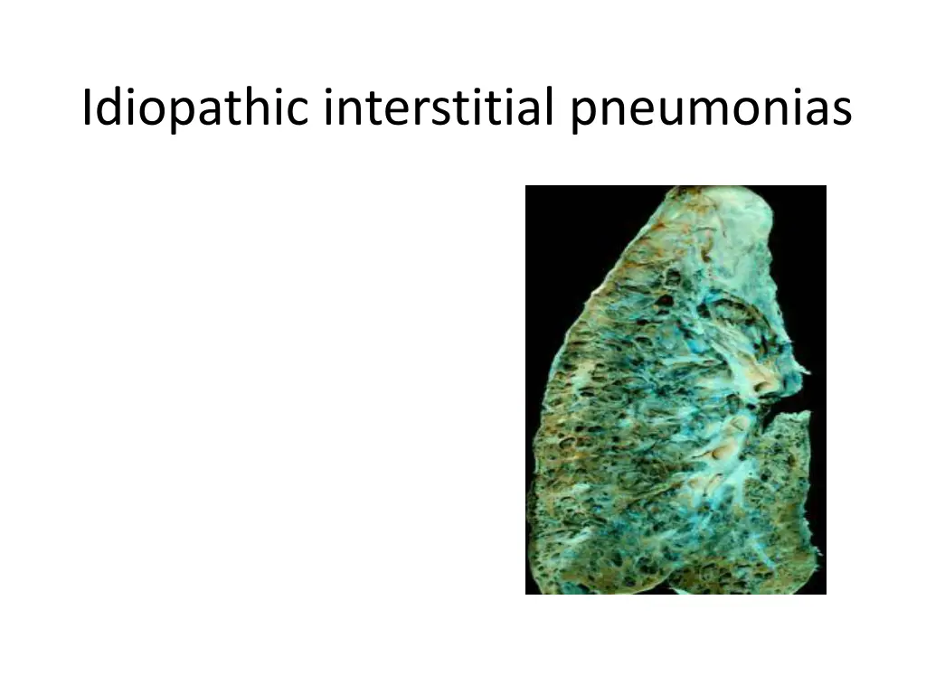 idiopathic interstitial pneumonias