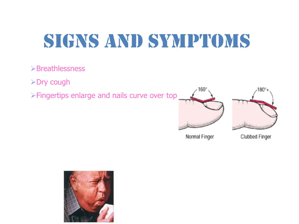 signs and symptoms