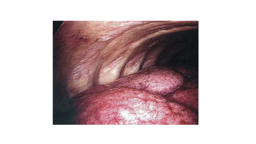 slide5
