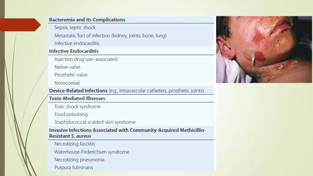 slide24