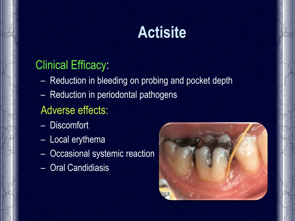 actisite