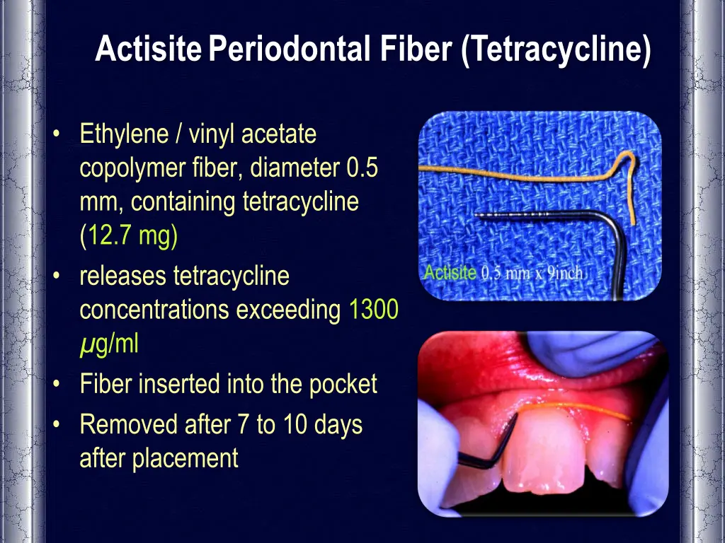 actisite periodontal fiber tetracycline