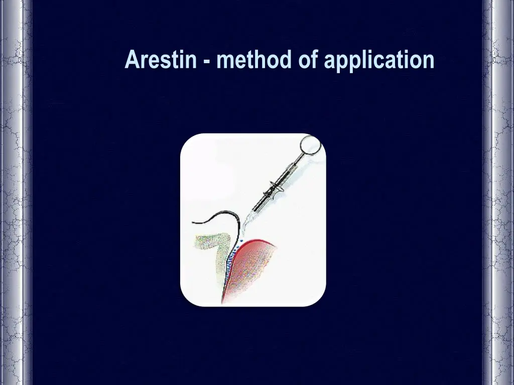 arestin method of application