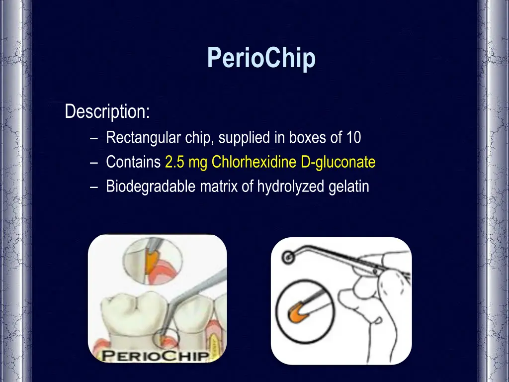 periochip