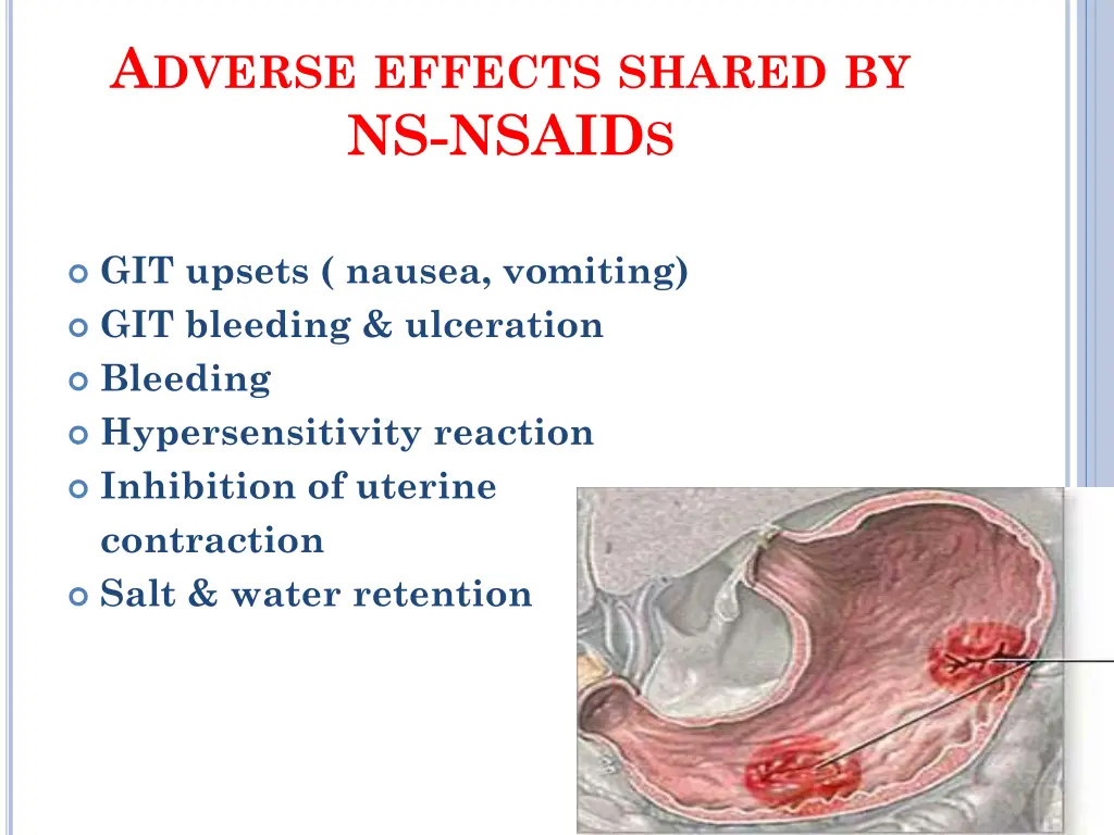 a dverse effects shared by ns nsaid s