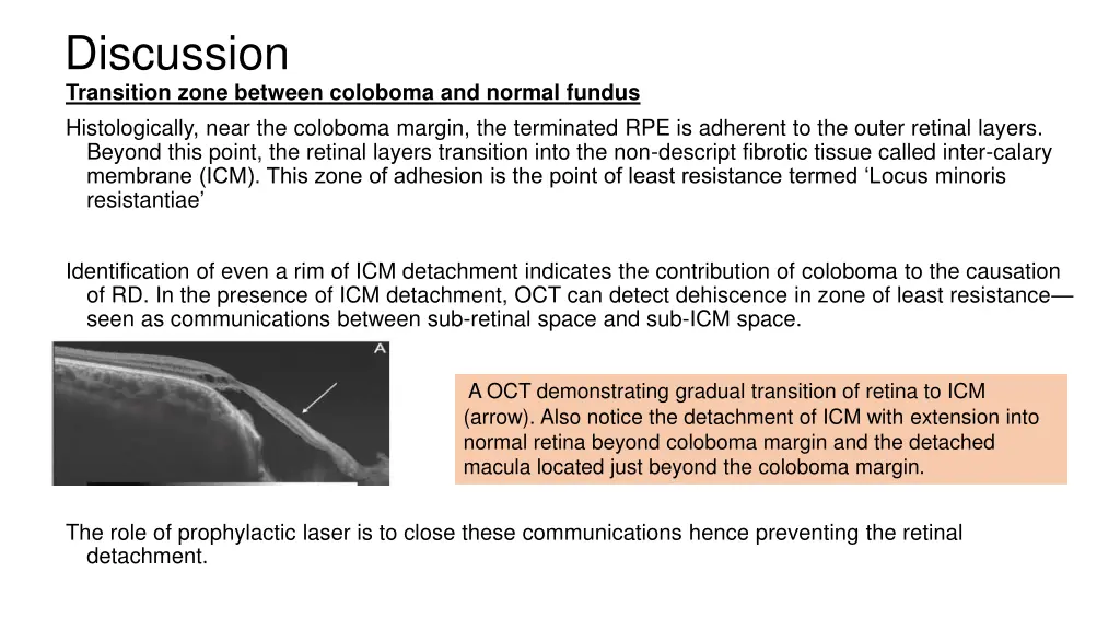 discussion transition zone between coloboma