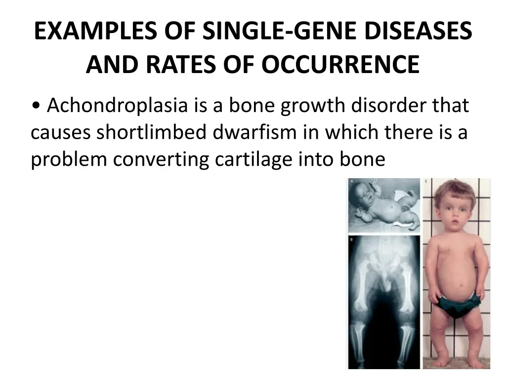 examples of single gene diseases and rates
