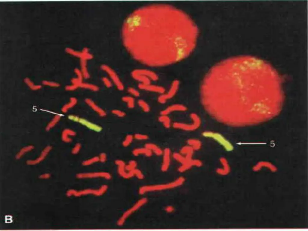 slide37