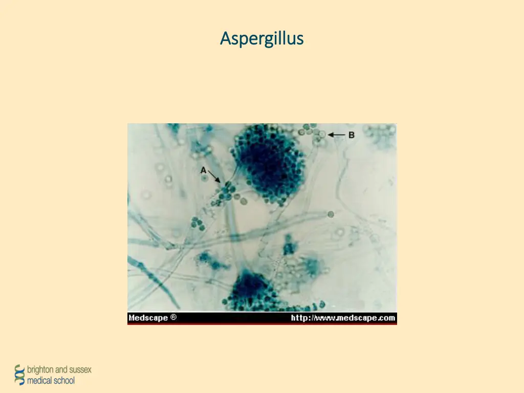 aspergillus aspergillus