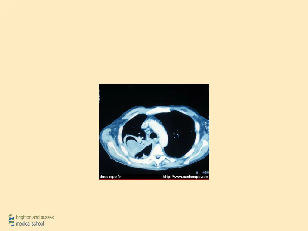 slide12